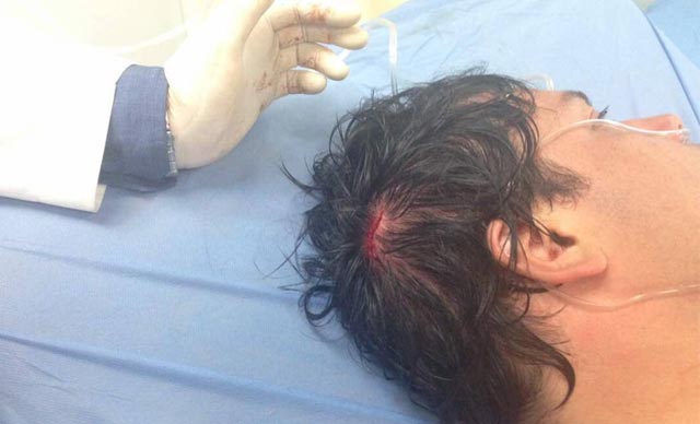 Diputado Paparoni fue herido en la cabeza durante manifestaciones en la autopista